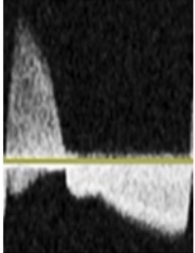 <p>What is the best descriptor of this waveform?</p>