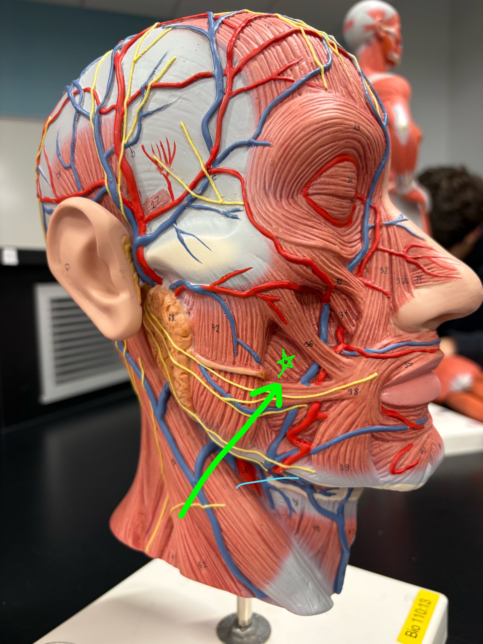 <p>Name the muscle.</p>