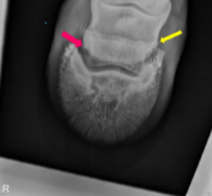 <p>What is the yellow arrow pointing to?</p>