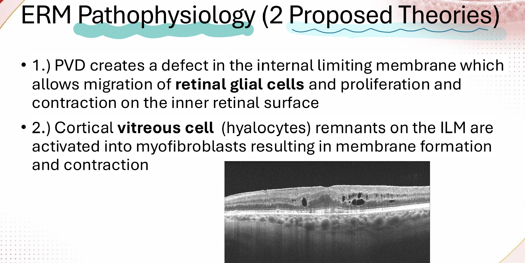 <p>the two ERM pathophys theories involve what cell types?</p>