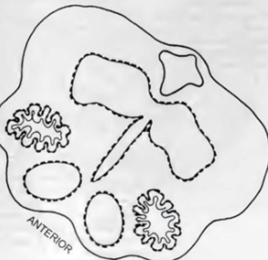 <p>Inferior part of brainstem containing the medulla oblongata</p><ul><li><p>Olives (olivary nucleus): on lateral sides of medulla —> connect to cerebellum</p></li><li><p>Pyramids (protrusions): ventral side of medulla —> voluntary motor signals from brain travel down these tracts to spinal cord; decussation site.</p></li><li><p>Reticular formation (posterior) to other structures. —> core of brainstem</p></li></ul><p></p>