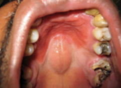 <ol start="54"><li><p>Identify the finding shown.</p></li></ol><p></p>