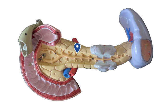 <p>Name this organ.</p>