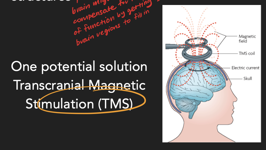 <h2 id="cbd74c14-772a-4d00-ba3e-41981d895696" data-toc-id="cbd74c14-772a-4d00-ba3e-41981d895696" collapsed="false" seolevelmigrated="true">Transcranial Magnetic Stimulation (TMS)</h2><p>A wand introduces a small transcient electromagnetic field into the neurons of area MT which acts like a lesion because it disrupts brain processes.</p>