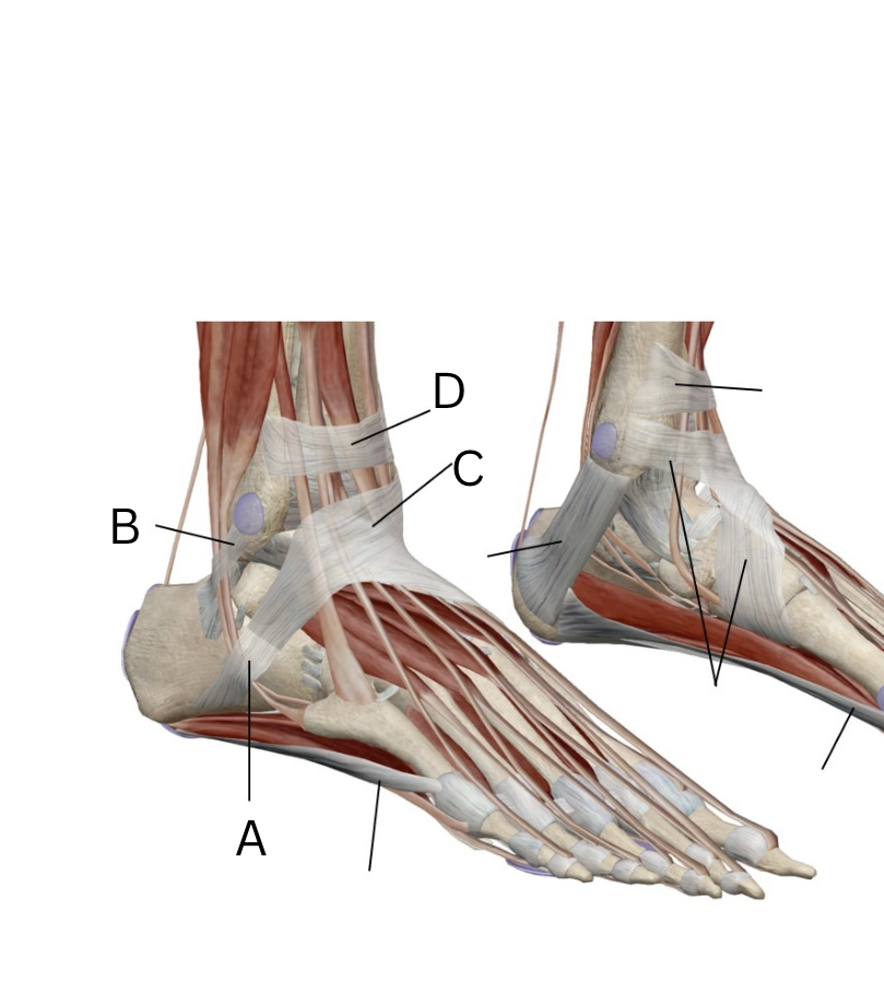 <p>Label these retinaculum? medial or lateral?</p>