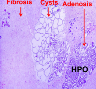 <p>What pathology? </p>
