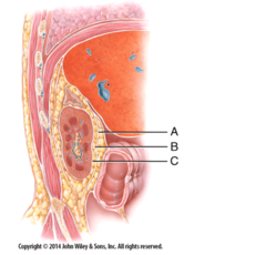 <p>c) C</p><p>—</p><p class="has-focus is-empty">A = Renal fascia</p><p class="has-focus is-empty">B = Adipose capsule</p><p class="has-focus is-empty">C = Renal capsule</p>