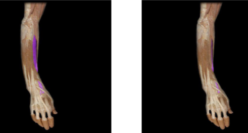 <p>wrist extension and radial deviation</p>