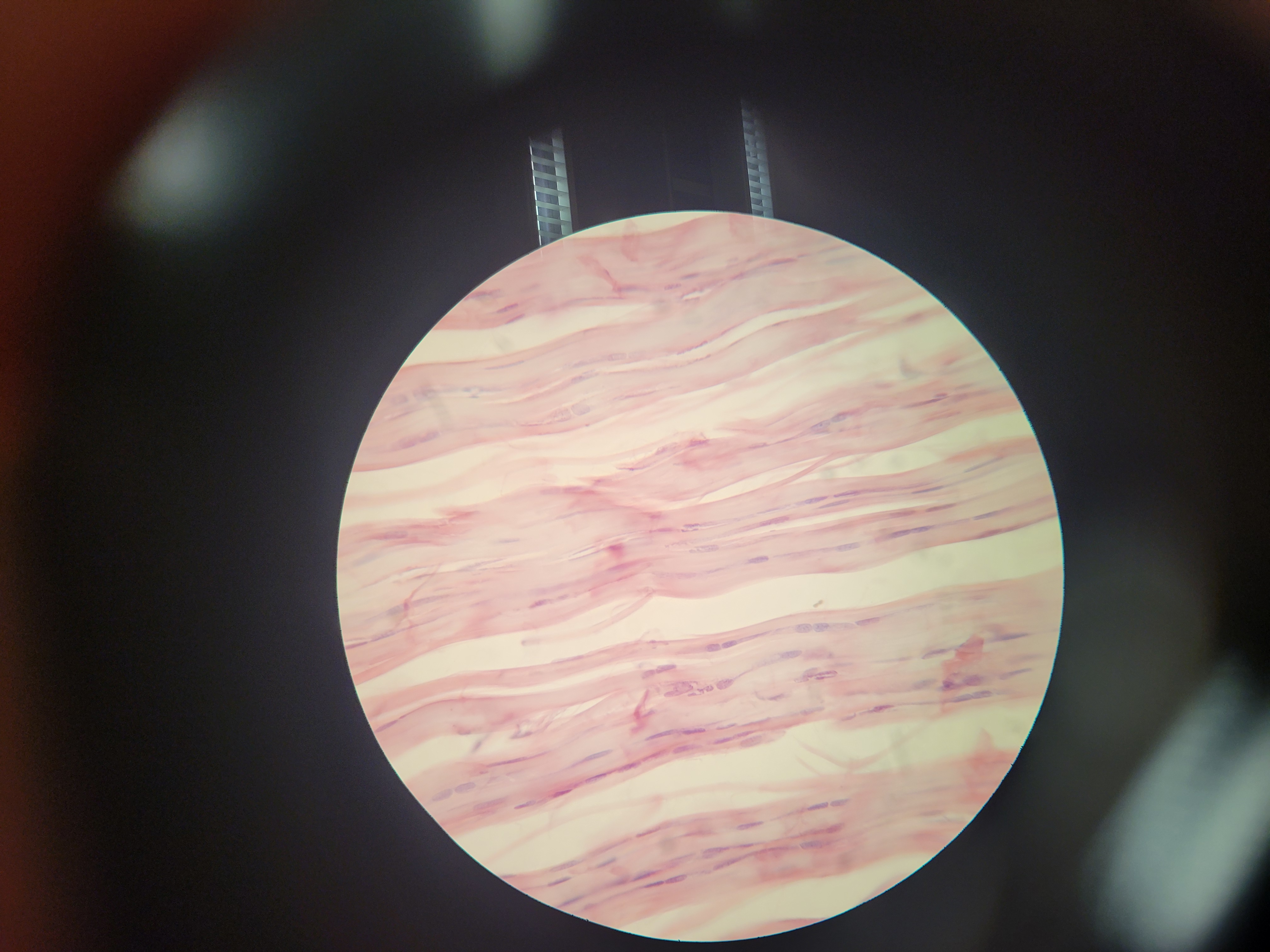 <p>What is shown? What tissue makes it up?</p>