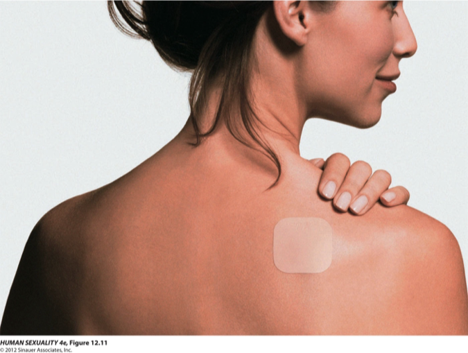 <ul><li><p>Replace every week</p></li><li><p>Contain varying amounts of ethinyl estradiol and norelgestromin (synthetic progestogen)</p></li><li><p>Mechanisms of Action</p><ul><li><p>Primarily inhibits ovulation</p></li><li><p>Thickens cervical mucus</p></li><li><p>Interfere with fertilization by altering tubal motility of ovum</p></li><li><p>Inflammation and atrophy of the endometrial lining</p></li></ul></li></ul><p></p>