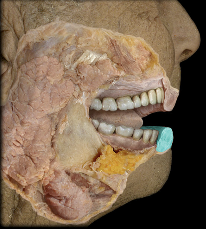 term image