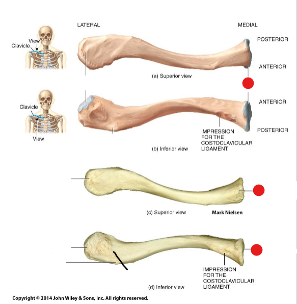 <p>Identify the structure pinned </p>