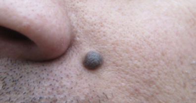 term image