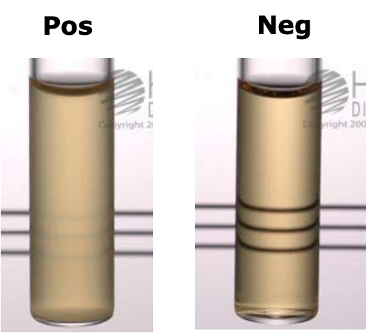 <p>Purpose: differentiate Enterococcus from Streptococcus bovis and Viridans Streptococcus (6.5% salt agar or broth)</p><p></p><p>Positive: growth, turbidity in broth or growth on agar plate</p><p>Negative: no growth</p>