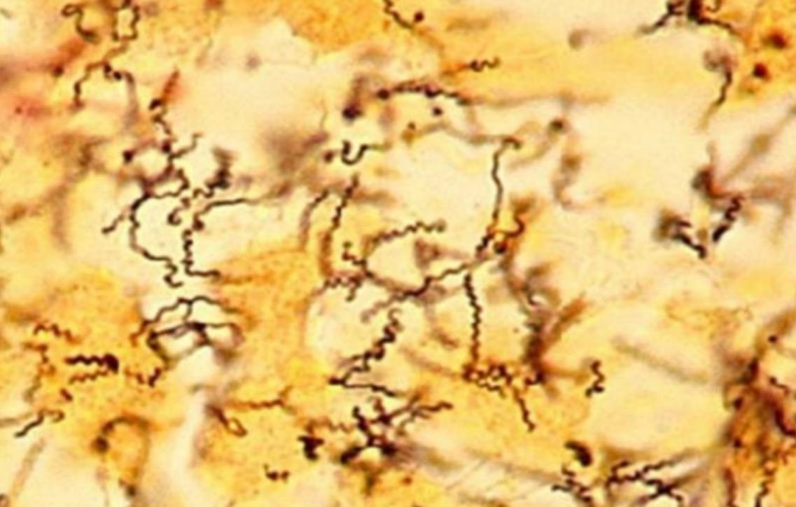 <p>Specimen (microscopically slide):</p><p>• Name of organism:</p><p>• Stain:</p><p>• Sample from: culture or pus or in tissue</p><p>• Morphology</p>