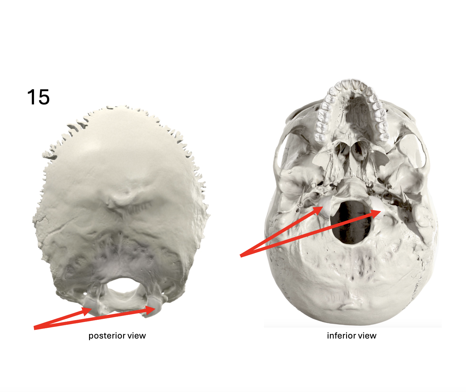 <p>Identify the <strong>bone and landmark</strong></p>