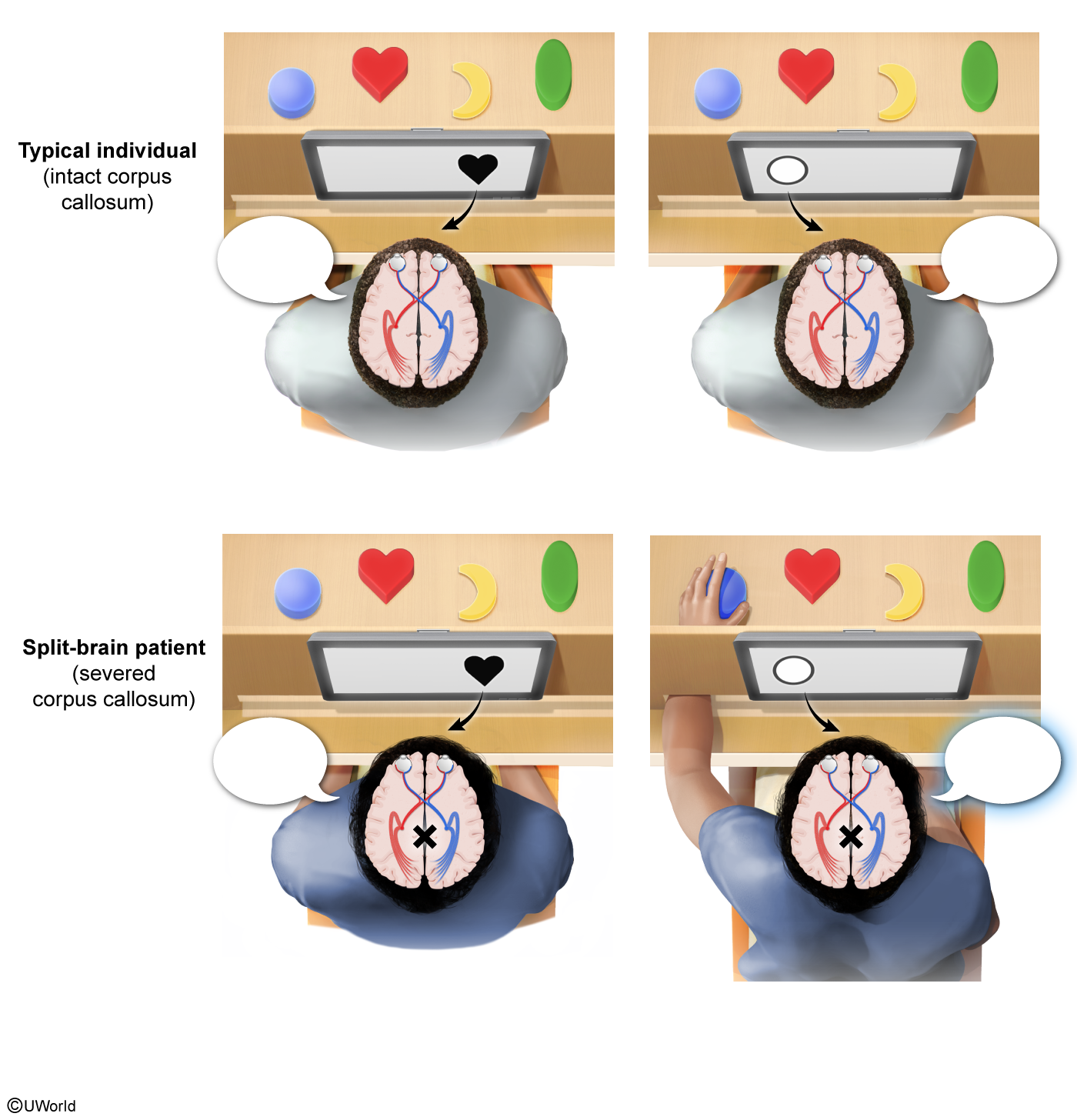 <p><span>Based on the scenarios shown below, label what these two individuals would say they can see on the monitor.</span></p>