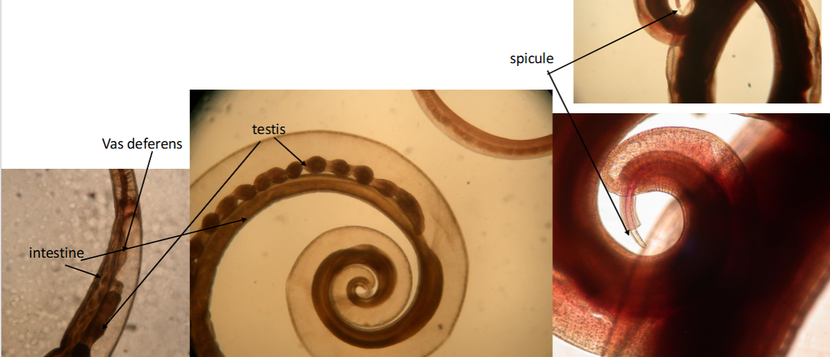 <p><span>Trichuris trichiura (whip worm) adult male</span></p>