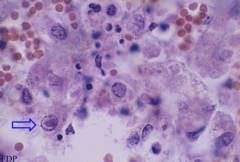 <p>On a horse farm, foals and yearlings have a respiratory disease outbreak in march. In may, the broodmares have late term abortions. You see intranuclear eosinophilic inclusion bodies in white foci spots on the liver. Thoughts?</p>