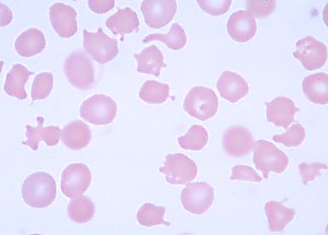 <p>poikilocyte </p>