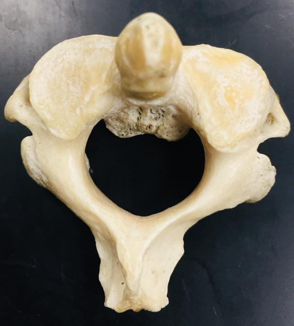 <p>name bone and structures</p>