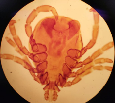 <p>Ixodidae, Adulto Macho de <em>Rhipicephalus sanguineus</em></p>