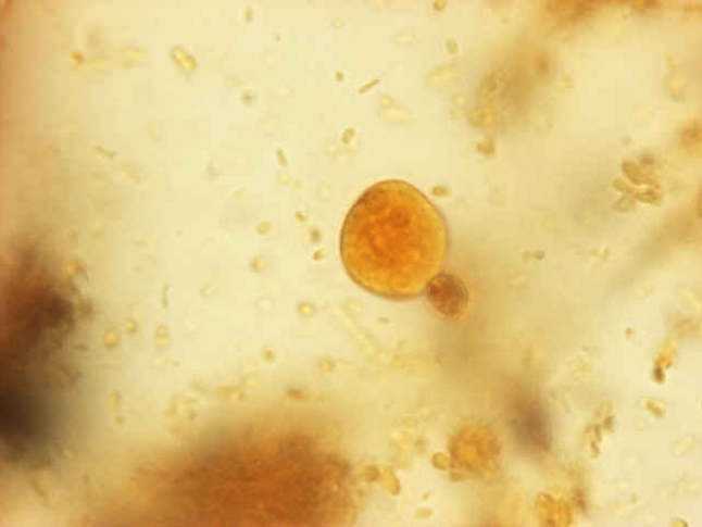 term image