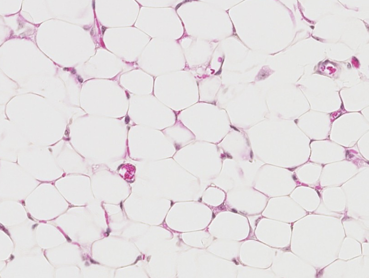 <p>what type of CT is this? be specific.</p>