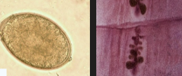 <p>Egg with tiny knob</p><p>Wide proglottid</p>