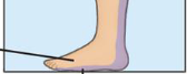<p>sole/posterior portion of foot</p><p>"‘plant’ foot to ground” bottom part of foot</p><p>short line</p>