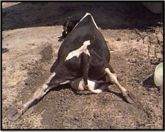 <p>What complication is of feto-maternal disproportion is being shown here?</p>