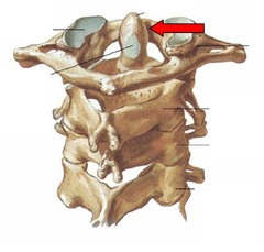 <p>Name Joint</p>