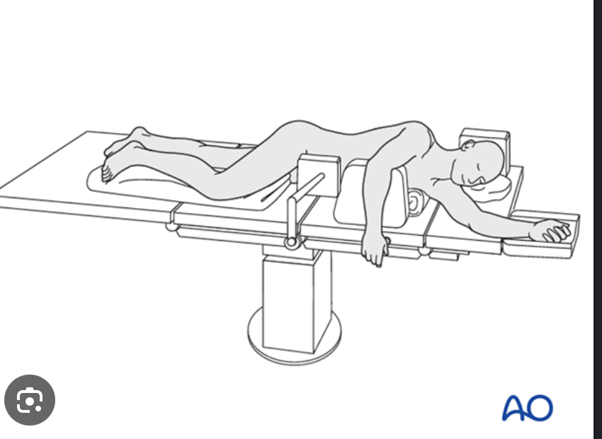 <p>Is a side lying position with the top hop and knee flexed and placed in front of body</p>