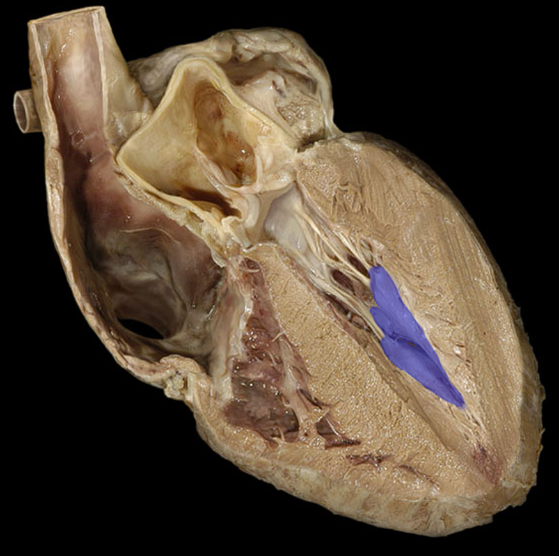 term image