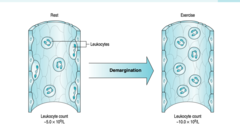 <p>- Depletion of neutrophil stores reduces their accumulation at inflammatory sites and in exudates</p>