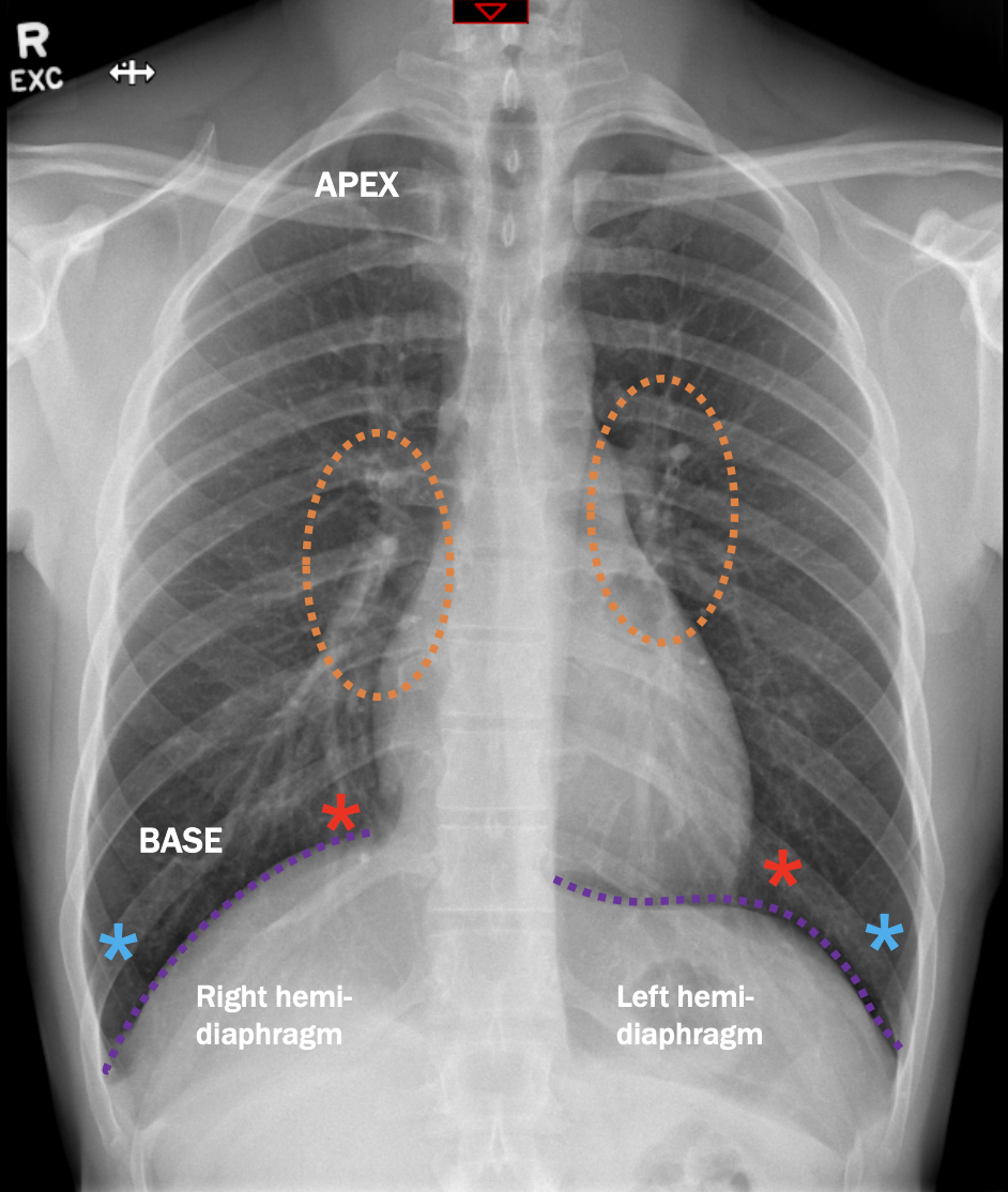 <p>What anatomy is labelled with the blue asterisk?</p>