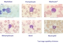 <p>1, Myeloblast</p><p>2. Promyelocyte</p><p>3. Myelocyte</p><p>4. Metamyelocyte</p><p>5. Band form</p><p>6. Mature form</p>