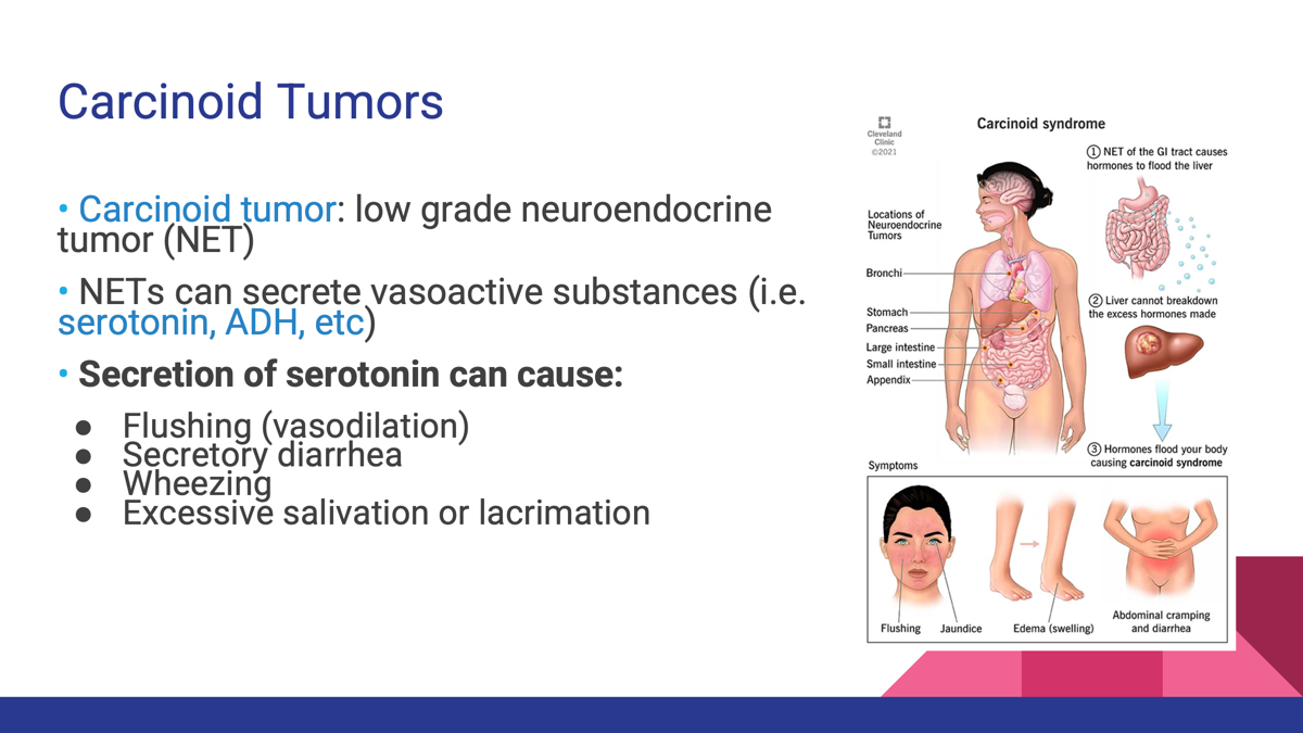 <ul><li><p>Low-grade <strong>neuroendocrine tumors (NETs)</strong>.</p></li><li><p>Arise from cells with endocrine and nervous system features.</p></li><li><p>Can secrete hormones such as <strong>serotonin</strong>.</p></li></ul><p></p><p></p><p><span>Neuroendocrine tumors (NET) arise from neural crest tissue. Cells migrate to submucosal layer of intestines and pulmonary bronchi thus they can at times express enzymes to produce peptide hormones. </span></p>