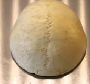 <p>Name This Structure</p>