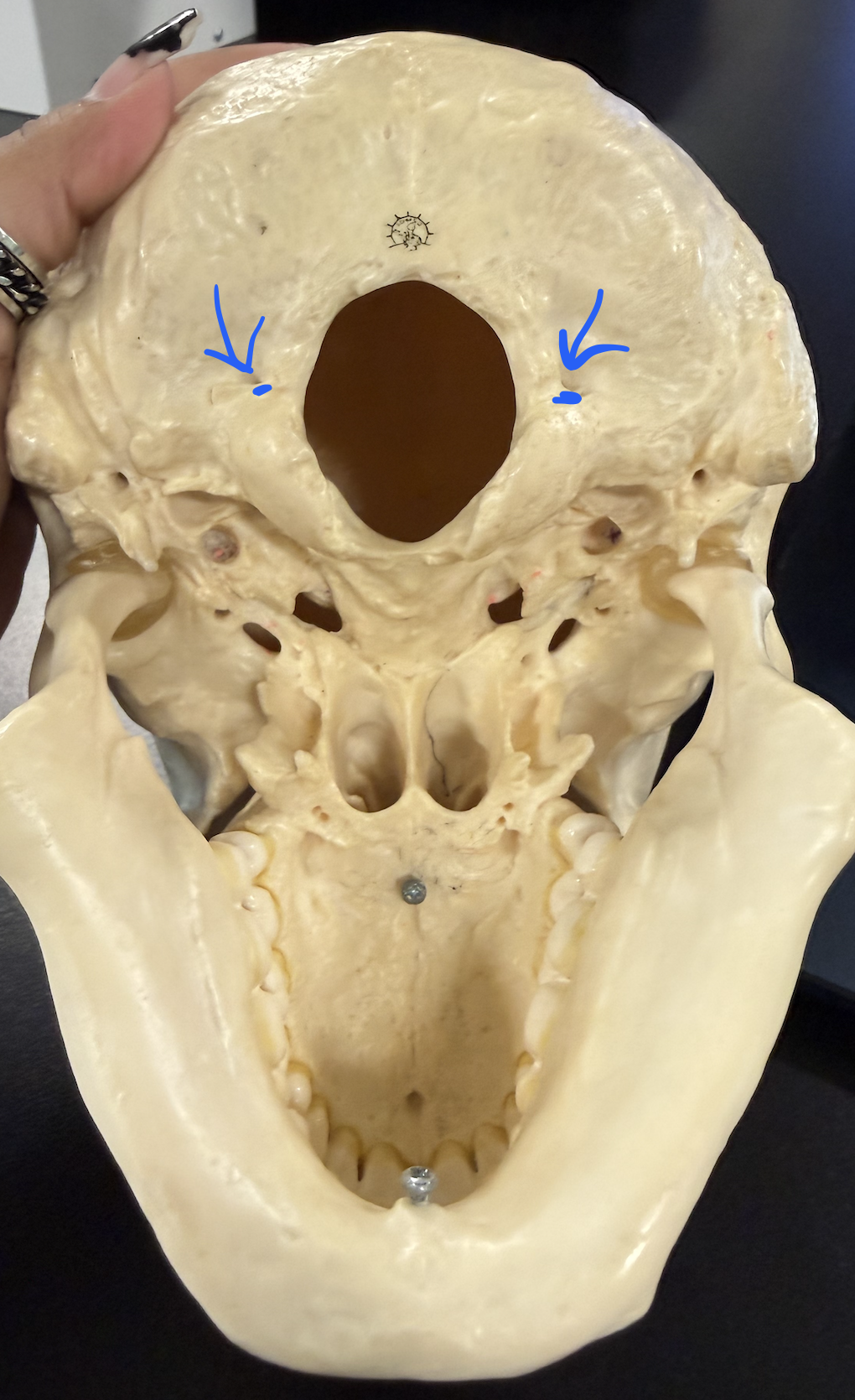 <p>for hypoglossal nerve; under occipital condyles (need to tilt to be visible)</p>