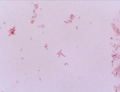 <p>PATHOGENIC BACTERIA:</p>