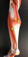 <p>- Soleus</p><p>- 2 head of Gastrocnemius</p>