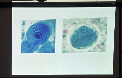 <p>What is this organism?</p>