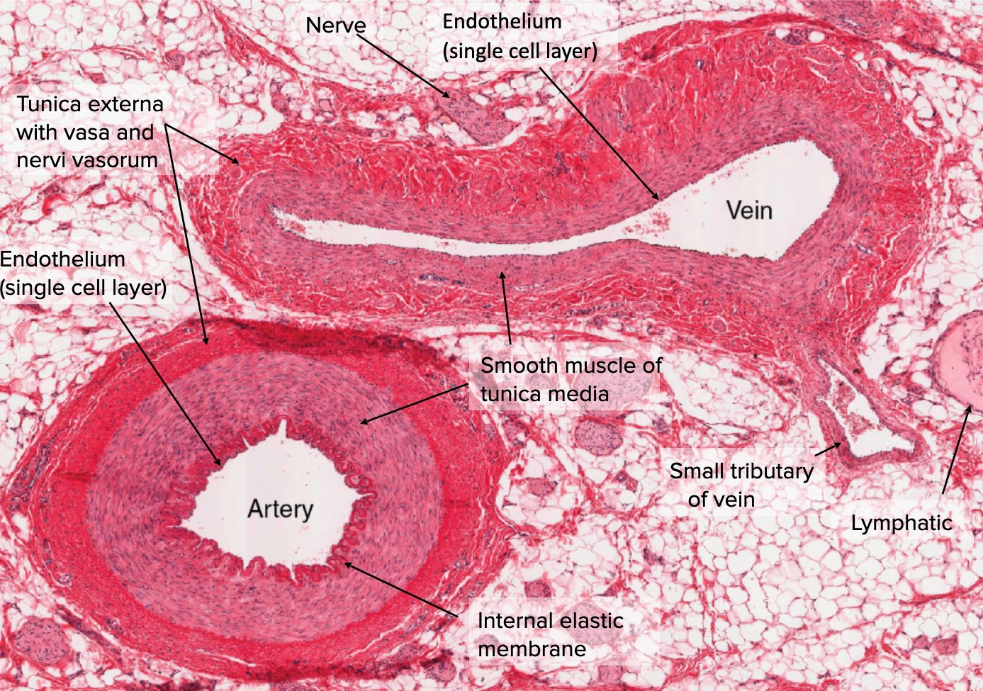 <p>tubes or channels carry blood from body’s capillary beds → heart</p><ul><li><p><strong>larger opening</strong> (carries more blood)</p></li><li><p>blood pressure declines by time blood has passed in/out of arterioles and capillaries</p></li><li><p>vein walls much<strong> thinner</strong> than arteries</p></li><li><p>return blood <strong>against gravity</strong> with <strong>less</strong> <strong>blood pressure</strong></p></li><li><p>closes to heart → widest in diameter</p></li></ul><p></p><ul><li><p><strong>simple squamous</strong> epithelium</p></li><li><p>lumen <strong>not round</strong></p></li><li><p>less muscle → collapse when less blood</p></li></ul><p></p>