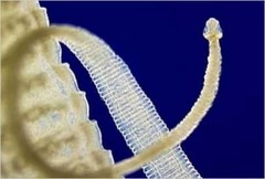 <p>Flatworms (platyhelminths), thorny-headed worms (acanthocephalins), and roundworms (nematodes).</p>