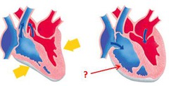 <p>D. ventricular relaxation</p>