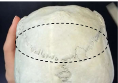 <p>parietal and occipital</p>