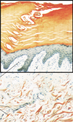 <p>a keratinized stratified squamous epithelium that contains four distinct types of cells: keratinocytes, melanocytes, tactile epithelial cells, and dendritic cells</p>