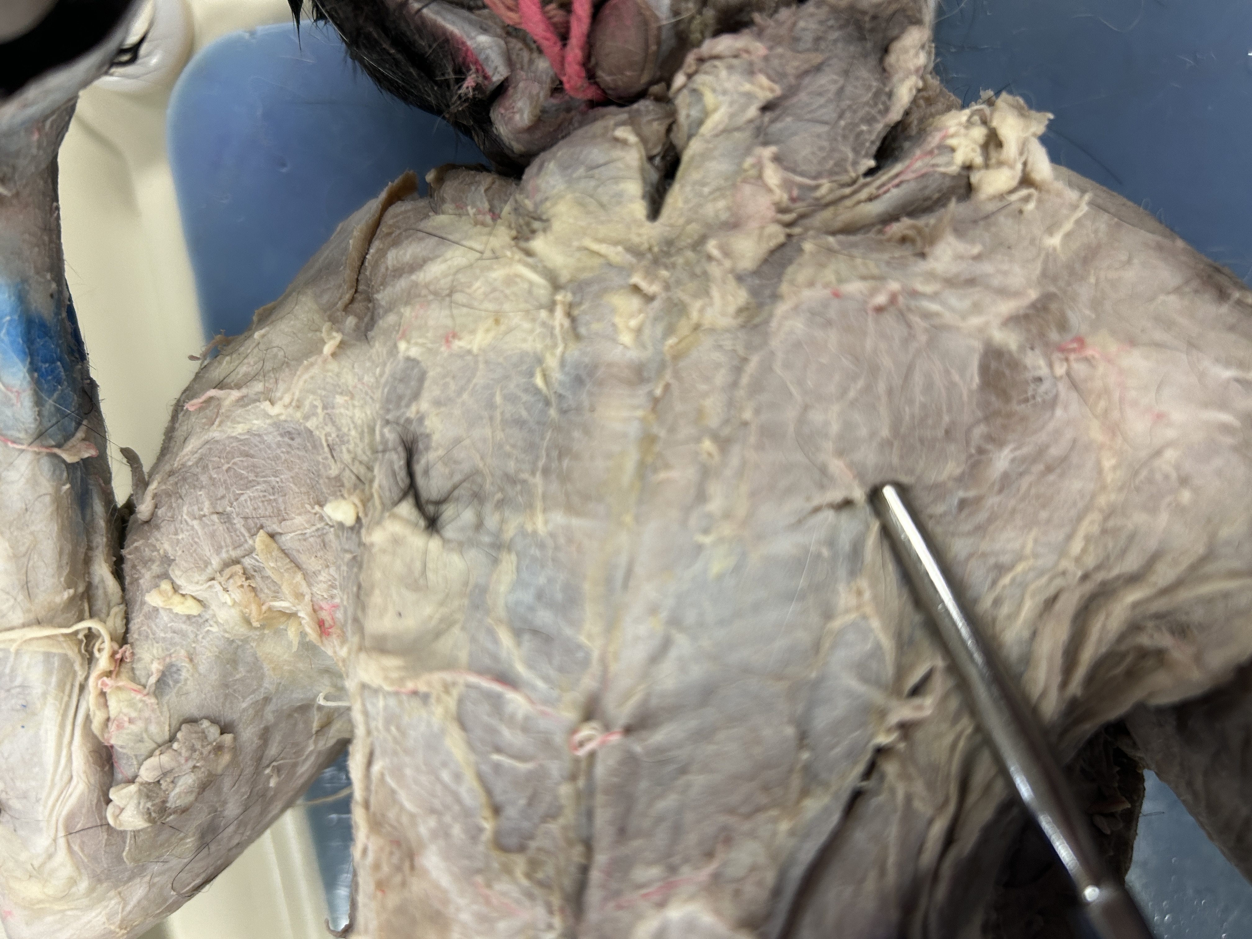 <p>Pectoantebrachialis(across middle of chest)</p>