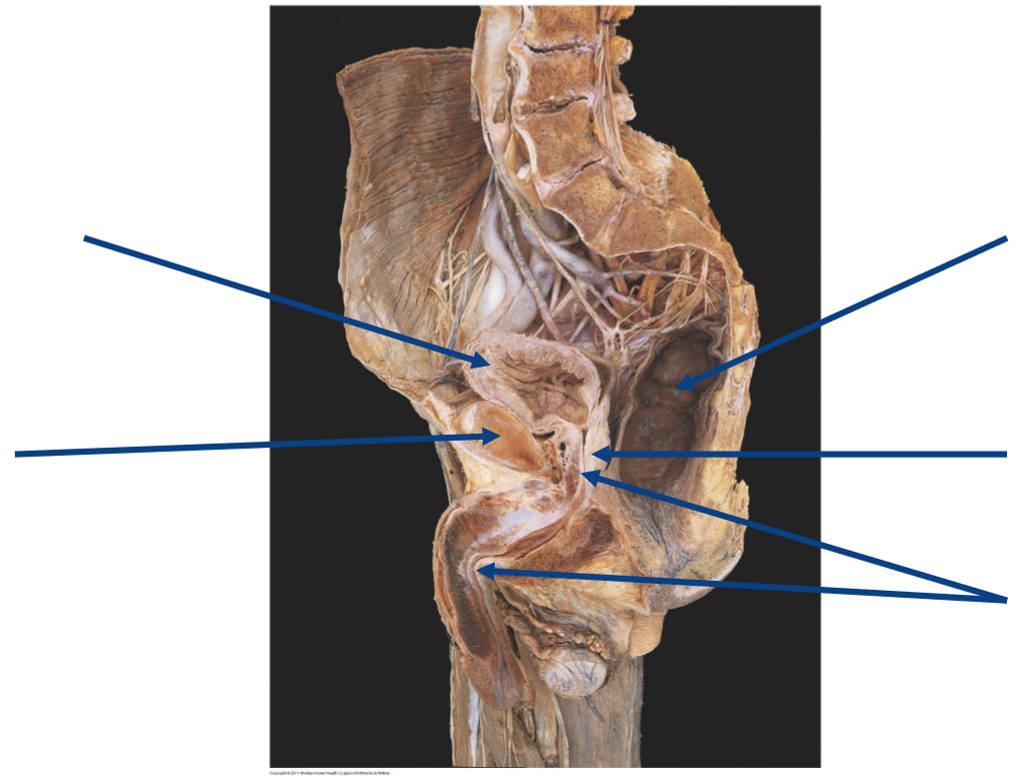 <p>Label the following image of the <strong>urinary bladder</strong> in its empty state</p>